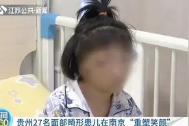 女孩没有耳朵没有眼睑 医生免费帮她重塑美丽笑脸图片