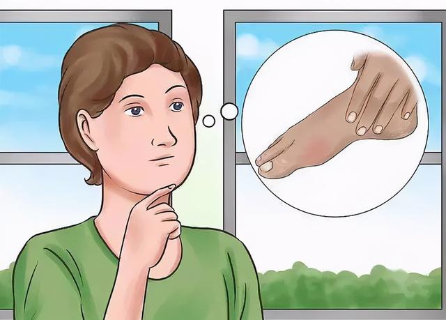 掌跎角化症跟绝经有关系吗