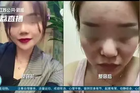 女子整形后鼻子歪了！院方称可修复，他们私自存了肋骨图片