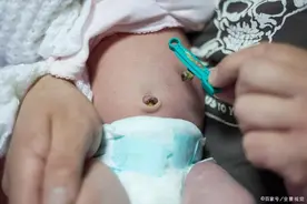 新生儿脐带几天会脱落，该如何护理？有些问题要注意，避免麻烦。图片