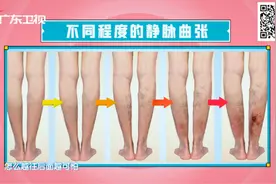 人体「第二心脏」保养手册图片