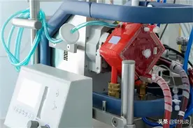 被欧美垄断的ECMO，普及率仅为德国1%，埋头20年终于实现国产图片