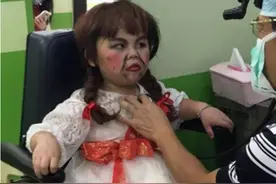 男孩被打扮成“娃娃”，到医院看牙逗笑牙医：没有世俗的欲望图片