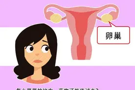 得了卵巢癌，身体上有一个征兆很“明显”，发现后，及时就医检查图片