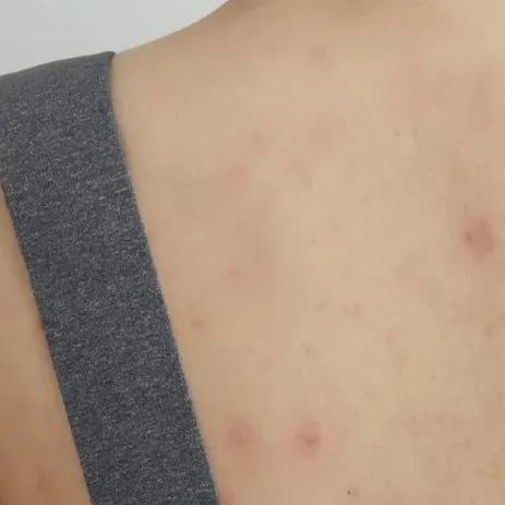 野脚鸡皮肤穿裙子 野脚鸡皮肤穿裙子