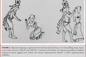 致敬医道先贤们：Chance骨折和Holdsworth骨折后面的故事（原创）图片