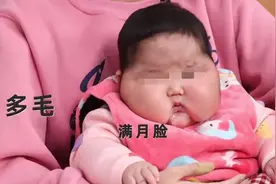 女婴用婴儿霜后成“大头娃娃”！脸硬得像石头，额头长满汗毛，最新通报→图片