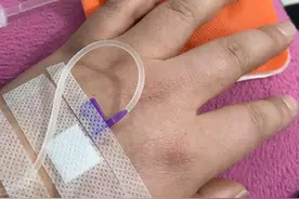 一个小细胞肺癌患者的心酸自述（一）图片