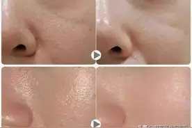 打水光针之前，你应该问清楚的几件事图片