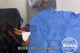 女子脖后突然多颗“痣”医生：幸好来得及时图片