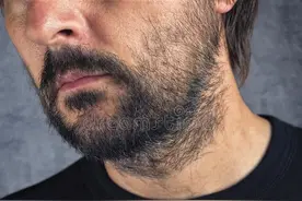 胡子长得快，雄性激素旺盛？别高兴太早，医生告诉您事情的真相图片