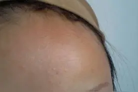 医生不会说的 | 扒一扒"整形美容的6大骗局"图片