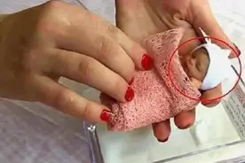 14年前出生时不足1斤的“拇指姑娘”，现状如何？网友：惊人反转图片