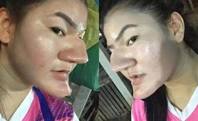 泰国女子花重金把自己整成老巫婆，网友：下巴可以当水果刀了