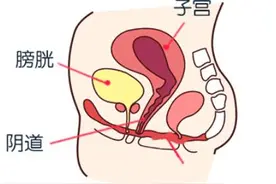 性欲减退了，查查盆底肌图片