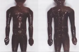 又一处工地发现汉墓，盗墓贼偷走了宝贝，却漏了神医扁鹊的医书图片