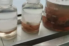 中年男子痛风石破溃后自己割脓，不降尿酸手脚长满痛风石图片