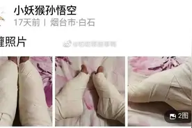 这种摧残女性身体的古代“美容术”，竟然有人想要复兴？图片