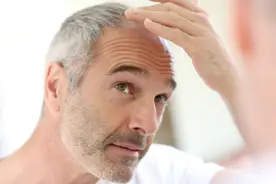 为什么头皮总长“疙瘩”和“脓包”？或许和3个原因有关，了解下图片