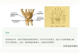 精华 | 1分钟读懂，腕关节外伤阅片技巧图片