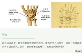 精华 | 1分钟读懂，腕关节外伤阅片技巧图片