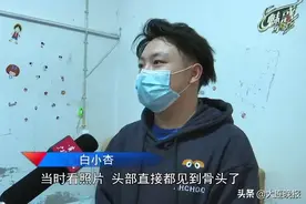 心疼！3个月大女婴家中头皮被啃，露出骨头 ！“真凶”让人毛骨悚然……图片