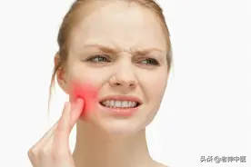 牙痛、牙龈肿痛，中医治疗各种牙痛的绝招图片