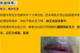 通过唇色看脾胃！如果你的嘴唇出现这6种情况，可能就是脾虚了？图片