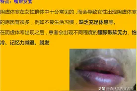 通过唇色看脾胃！如果你的嘴唇出现这6种情况，可能就是脾虚了？图片