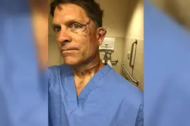 近400斤黑熊闯进家中，美国男子为救孩子拼死搏斗：它给我一拳，又把我转了个圈图片