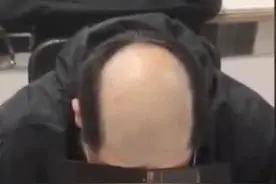 小伙被女朋友恶搞剃地中海发型：没有界限感的爱情最伤人图片