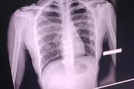 “​​女生做胸透时发生的尴尬事！哈哈哈社会性死亡......”图片