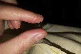 为什么我没有拉丝白带图片