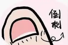 频繁洗手致“倒刺”丛生 医生提醒：勿随意撕扯“倒刺””图片