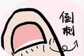 频繁洗手致“倒刺”丛生 医生提醒：勿随意撕扯“倒刺””图片