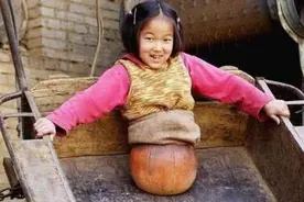 还记得当年的“篮球女孩”吗？19年后的她装上假肢后，现状如何图片