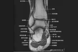 踝关节磁共振（MRI）解剖--精品图集图片