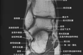 踝关节磁共振（MRI）解剖--精品图集图片