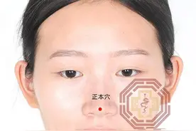 中医健康养生之人体头部穴位正本穴图片