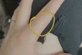 据说每个人的左手食指上，都有一个或深或浅的疤图片