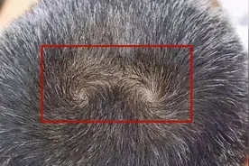 “双旋男孩找不到，双旋女孩没人要”，关于头上的旋，这几点要懂图片