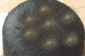 孩子头顶“旋”代表什么？老人说法一旋精两旋拧，不妨用科学解释图片