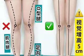 O型腿难道都需要矫正吗，不矫正不可以吗？好像真没有疼痛感图片
