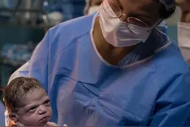 巴西“臭脸”女宝火了，怒目圆睁凝视医生，网友：表情包新素材图片