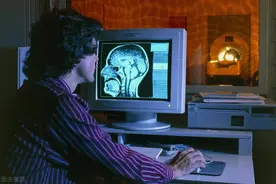 拍片、CT、磁共振，哪个才是肿瘤筛查神器？图片