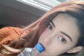 周杰伦老婆昆凌受伤，在家意外撞到头部，经纪人亲自探访后报平安图片