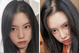 颅顶低怎么救？发际线太高咋办？几个简单小技巧解决这些烦恼图片