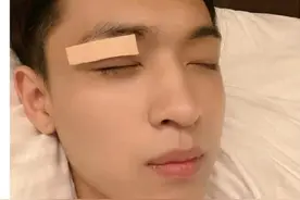 德云社秦霄贤录综艺右眼受伤！伤口打码惹人注目，节目组叫停录制图片