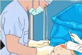 健康科普堂 | 疫情期间，眼科手术后能否按时复诊？图片