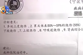 烫伤之后不要慌，急救讲究四个字图片